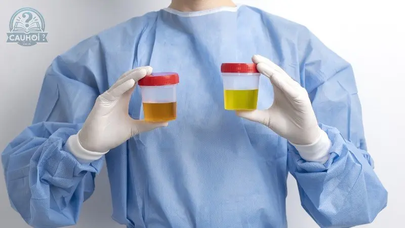 Lời khuyên sức khỏe và cách giữ cân bằng nước