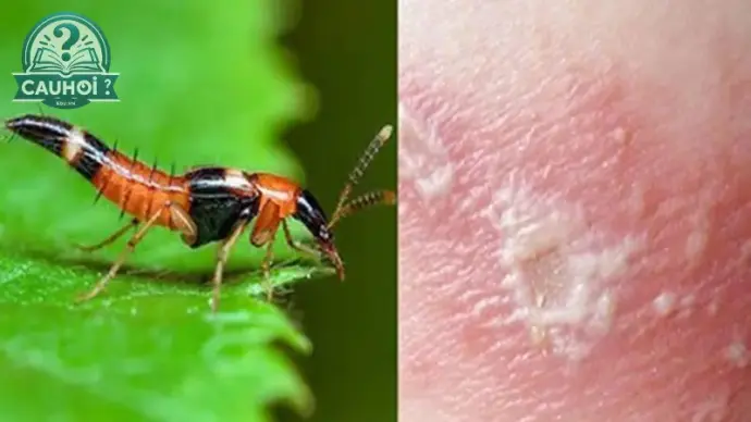 Tác hại của kiến 3 khoang - Những điều lưu ý để bảo vệ gia đình