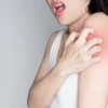 Bệnh ghẻ: Nguyên nhân, dấu hiệu và cách điều trị hiệu quả