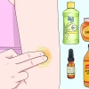 Cách làm bong vảy vết thương nhanh chóng và hiệu quả