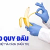 Hẹp bao quy đầu là gì? Dấu hiệu, nguyên nhân và cách điều trị