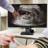 Thai nhi 10 tuần phát triển như thế nào và những thay đổi mẹ bầu cần biết