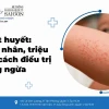 Vì sao bị sốt xuất huyết? Nguyên nhân và dấu hiệu nhận biết