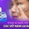 Vì Sao Dùng Kem Trị Nám Lại Khiến Vết Nám Đậm Hơn? Giải Pháp Hiệu Quả