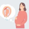 Vỡ ối là như thế nào? Dấu hiệu nhận biết và cách xử lý an toàn