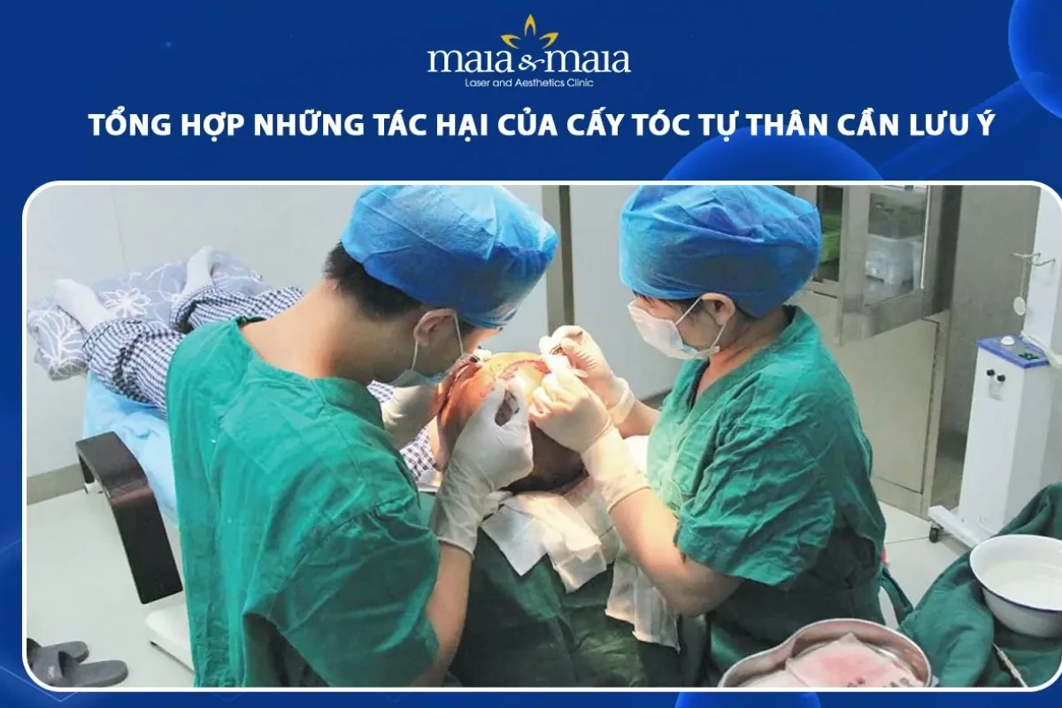 Tác hại của cấy tóc tự thân những điều cần biết