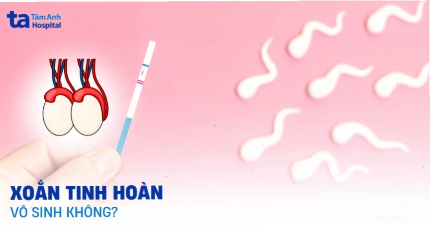 Ảnh hưởng của xoắn tinh hoàn đến khả năng sinh sản