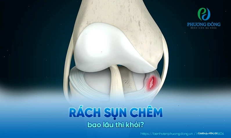 Bác sĩ đang hướng dẫn tập vật lý trị liệu