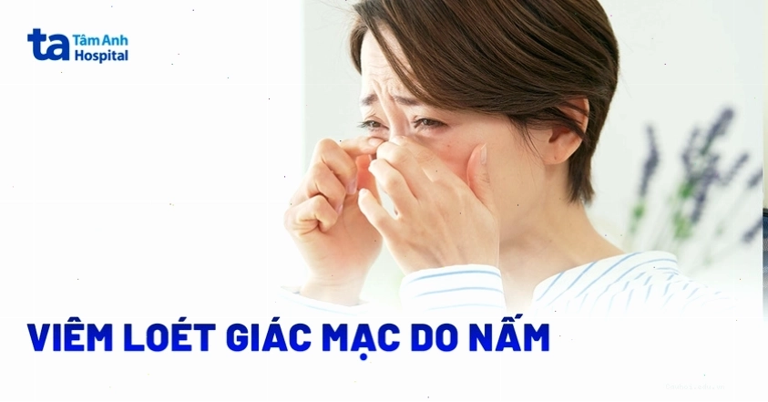 Bác sĩ đang kiểm tra mắt bằng thiết bị chuyên dụng