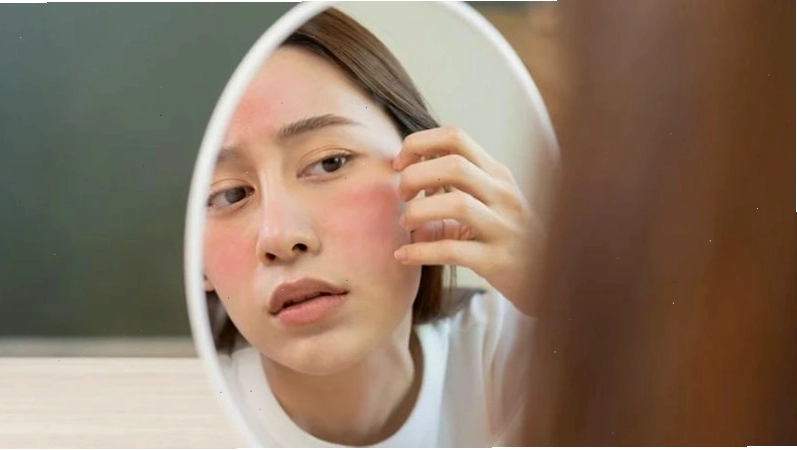 Baking soda thoa lên mặt có thể gây kích ứng da