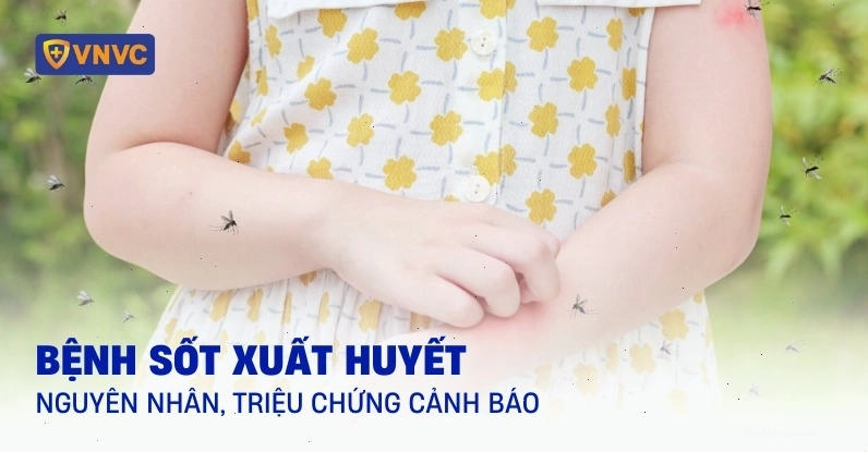 Bệnh sốt xuất huyết ở trẻ em cần được theo dõi sát sao