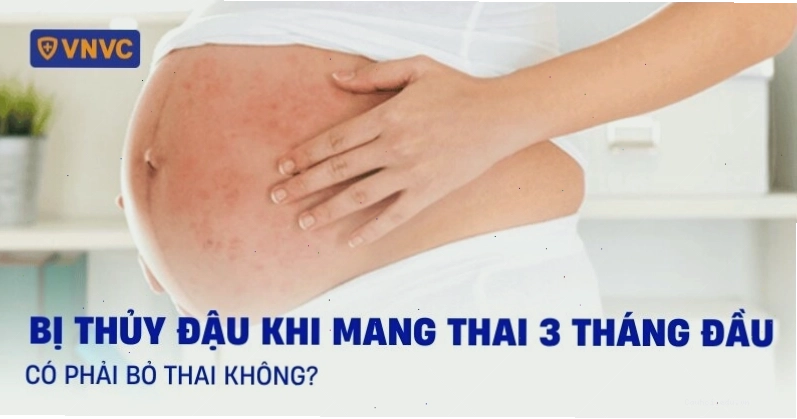 Bị thủy đậu khi mang thai 3 tháng đầu