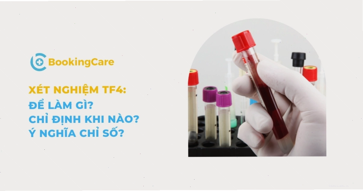 Biểu đồ minh họa kết quả xét nghiệm FT4