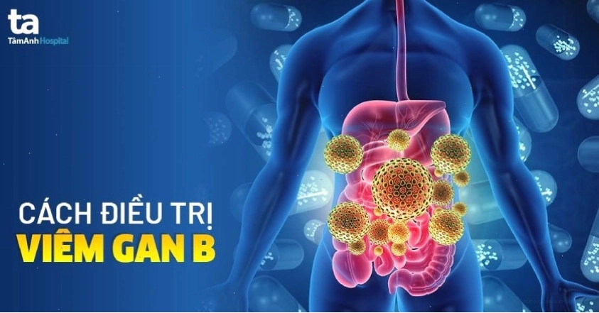 Các phương pháp điều trị viêm gan B hiệu quả