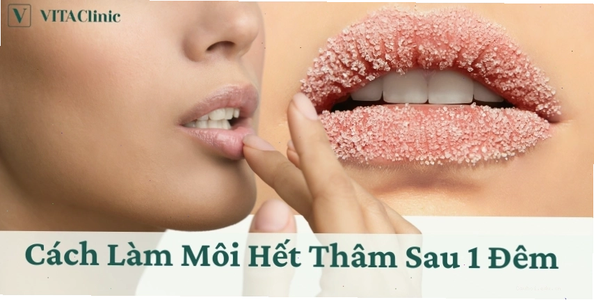 Cách làm môi hết thâm sau 1 đêm đơn giản và hiệu quả