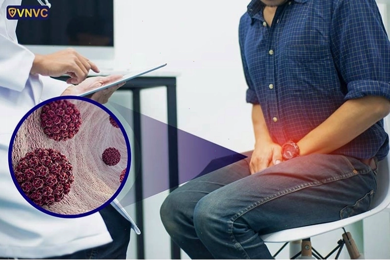 Chi tiết hình ảnh sùi mào gà ở nam
