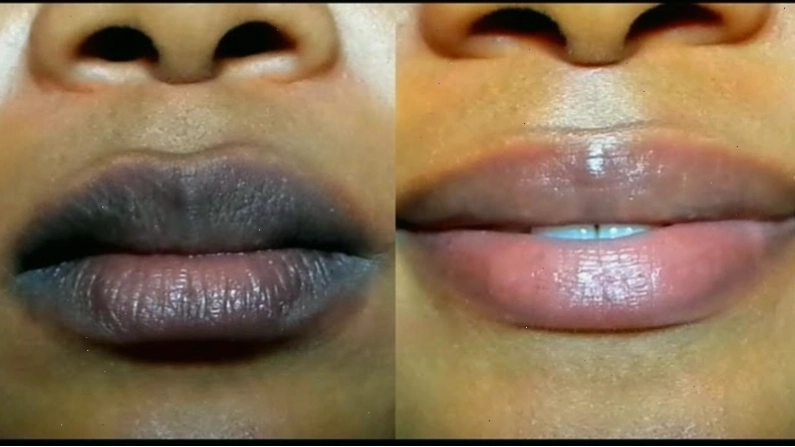 Cơ địa khách hàng là một trong những yếu tố ảnh hưởng đến màu sắc phun môi