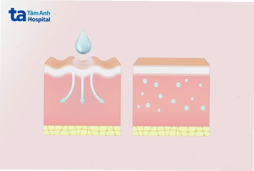 Da mặt khô và thiếu nước dẫn đến hình thành nếp nhăn