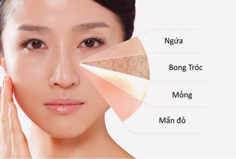 Da nhạy cảm là tình trạng da dễ bị kích ứng và phản ứng mạnh với các tác nhân