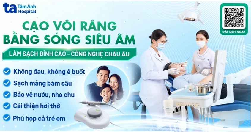 Dịch vụ cạo vôi răng chuyên nghiệp