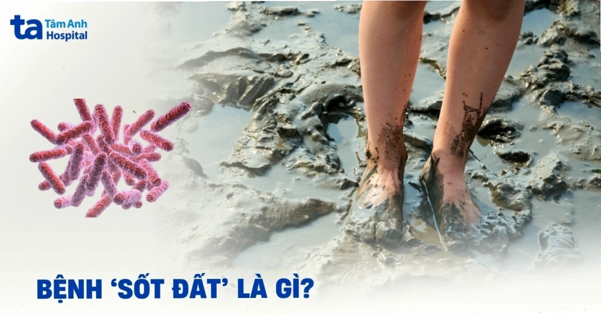 Đồ họa mô tả cấu trúc tuyến lệ và tuyến dầu trên mi mắt