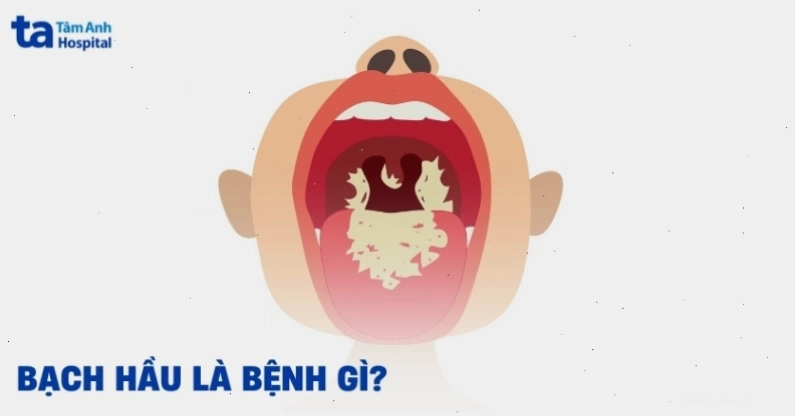 Dụng cụ y tế dùng để kiểm tra mắt