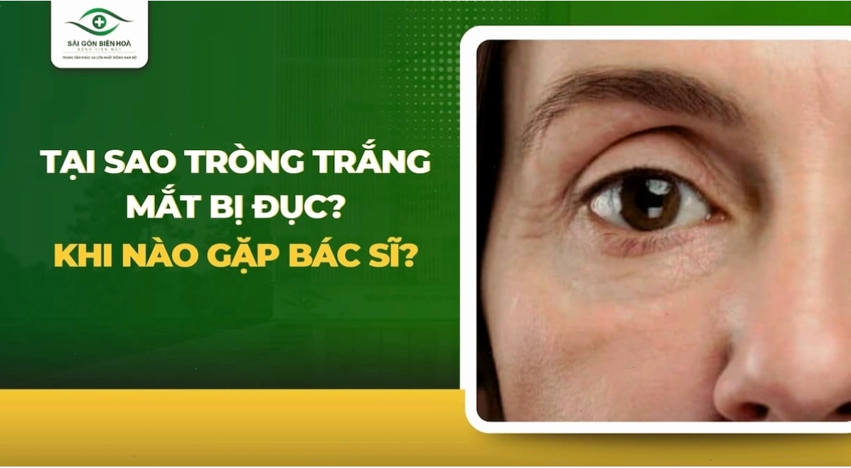 Giải thích nguyên nhân lòng trắng mắt bị đục