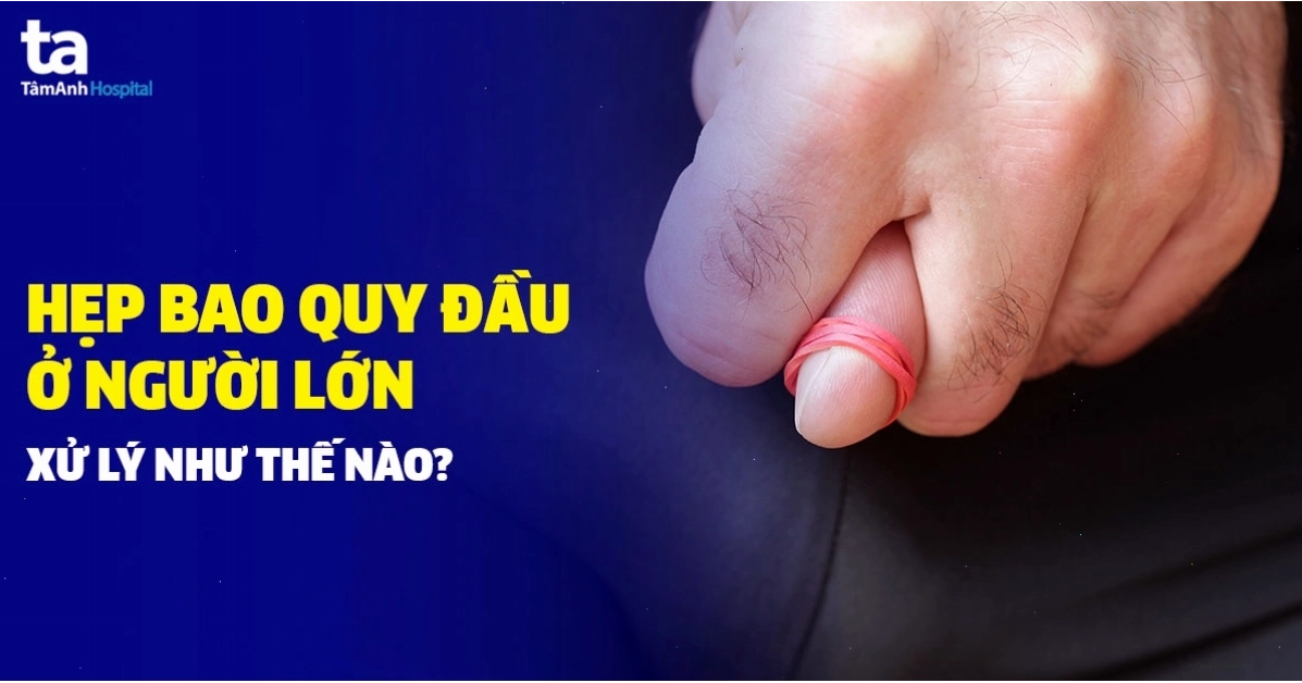 Hẹp bao quy đầu ở người lớn