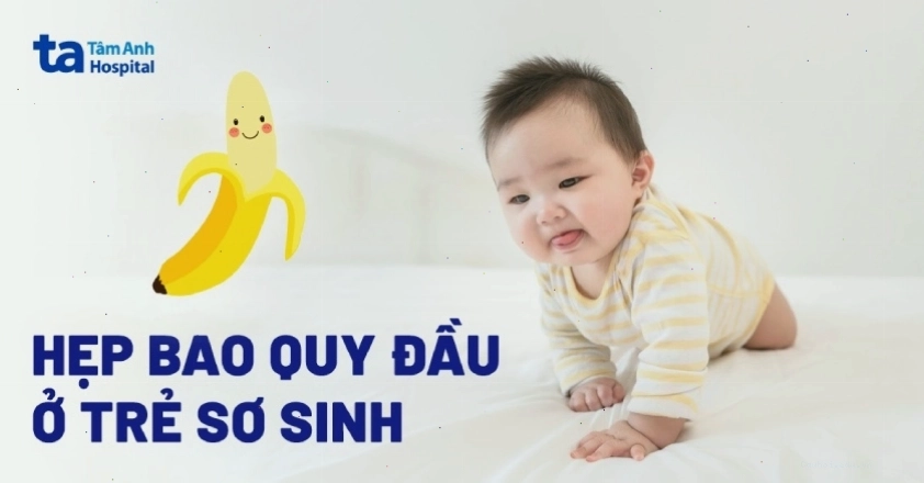 Hẹp bao quy đầu ở trẻ sơ sinh
