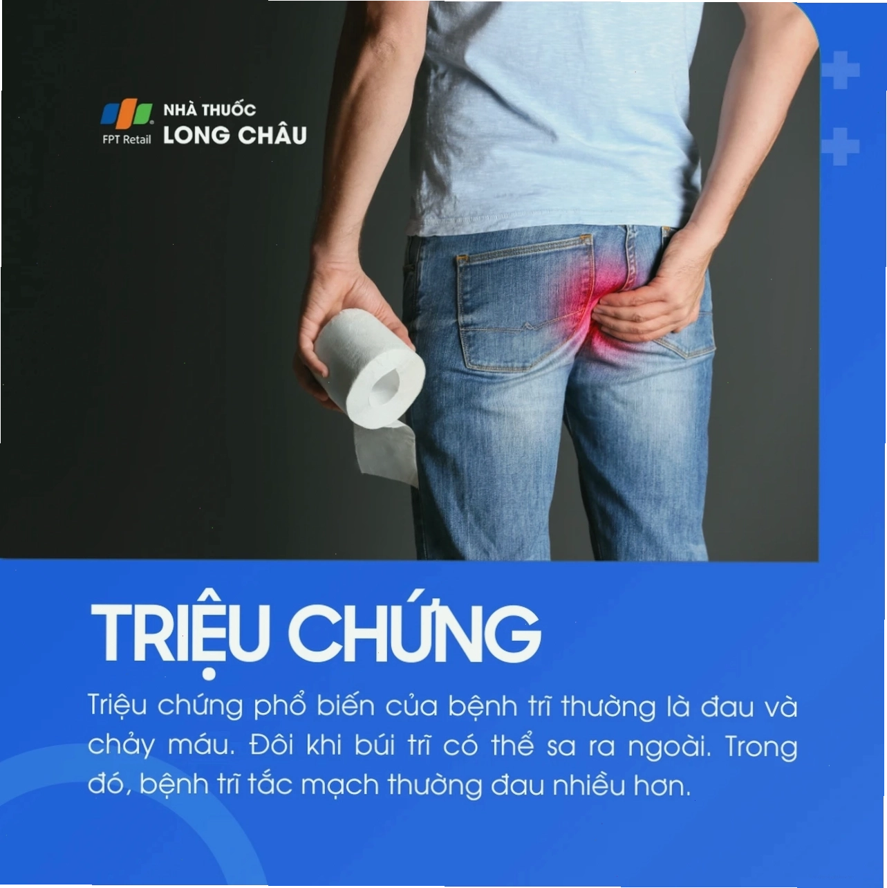 Hình ảnh minh họa bệnh trĩ