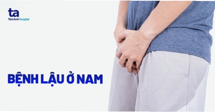 Hình ảnh minh họa triệu chứng bệnh lậu ở nam giới
