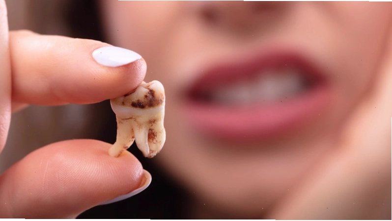 Hướng dẫn vệ sinh răng miệng đúng cách để phòng ngừa sâu răng