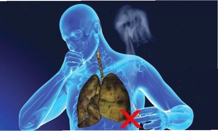 Hút thuốc lá là yếu tố nguy cơ cao mắc các bệnh về đường hô hấp