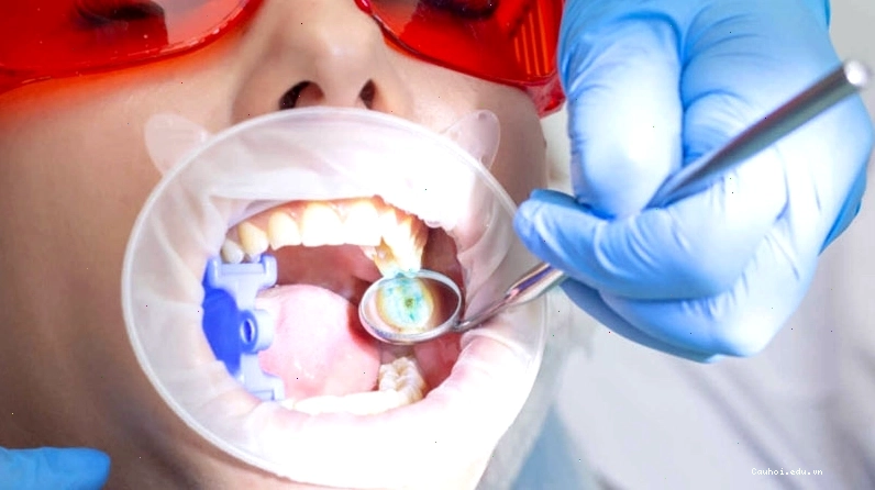 Khám răng định kỳ để phát hiện sớm các vấn đề răng miệng