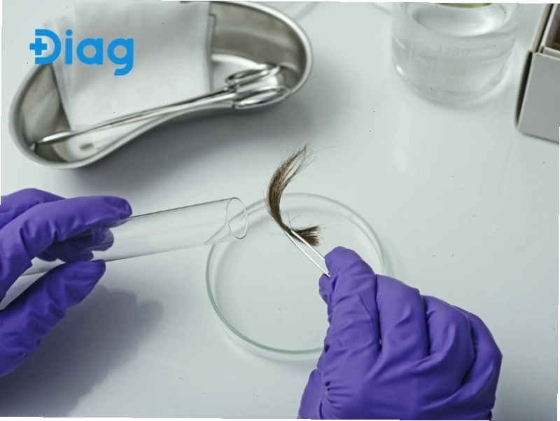 Khi lấy mẫu tóc để xét nghiệm ADN, cần đảm bảo còn nguyên chân tóc để có kết quả chính xác.