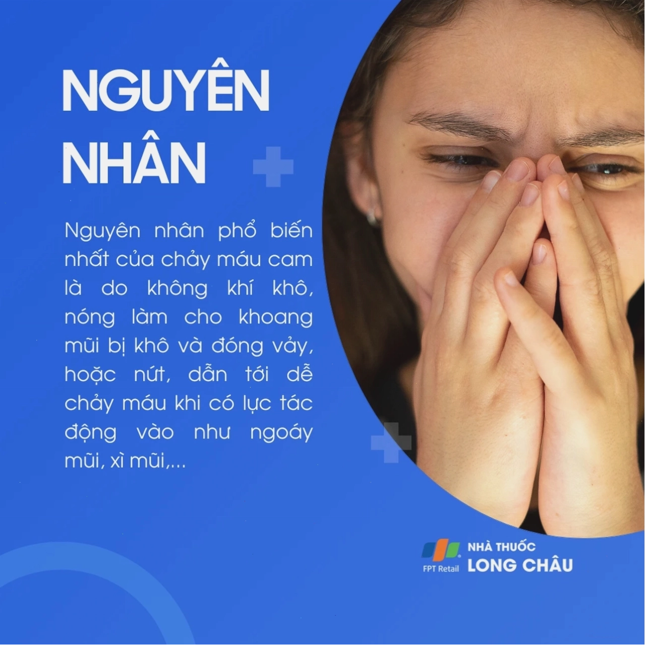 Không khí khô, nóng, ngoáy mũi, xì mũi mạnh… là nguyên nhân phổ biến gây chảy máu cam