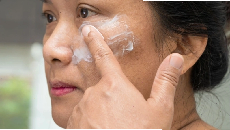 Kích ứng da khi dùng kem trị nám là nguyên nhân khiến nám đậm hơn