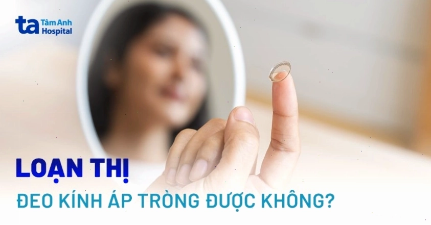 Mắt loạn thị có đeo kính áp tròng được không