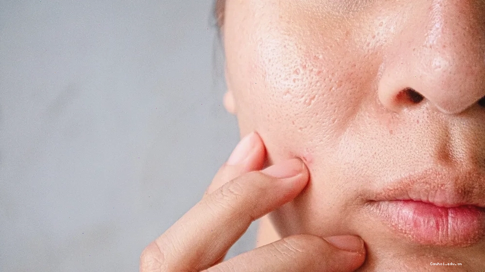 Mặt nạ khoai tây và lòng trắng trứng gà giúp se khít lỗ chân lông