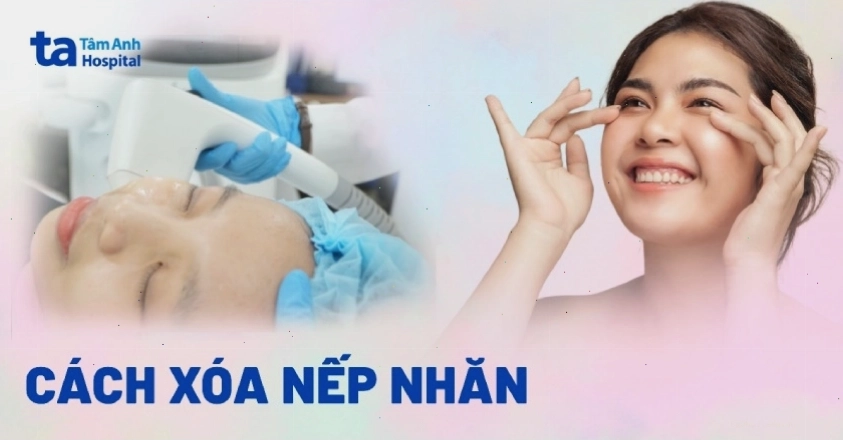 Minh họa các phương pháp xóa nếp nhăn hiệu quả