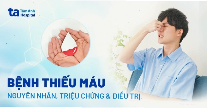 Minh họa tình trạng thiếu máu với làn da xanh xao