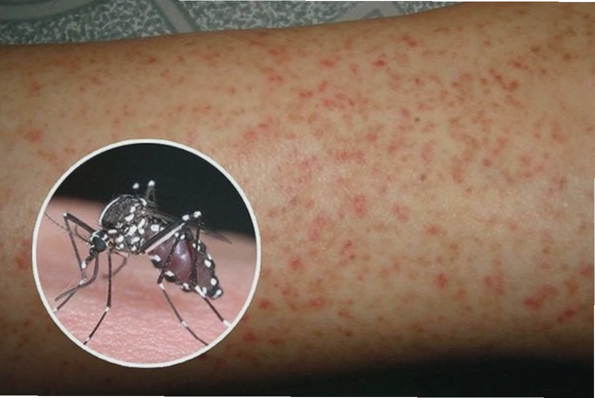 Muỗi vằn Aedes aegypti là tác nhân chính gây bệnh sốt xuất huyết