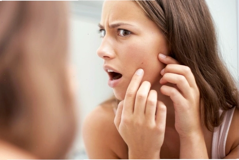 Ngủ muộn gây ra các vấn đề về da như mụn trứng cá
