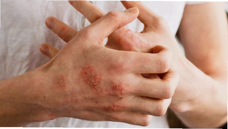 Người mắc bệnh tự miễn cần thận trọng khi dùng đông trùng hạ thảo