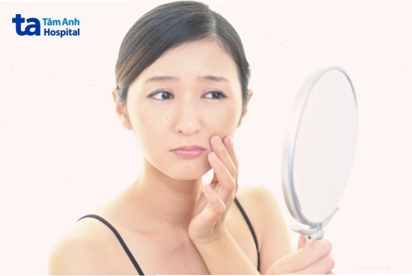 Nguyên nhân xuất hiện rãnh cười theo thời gian