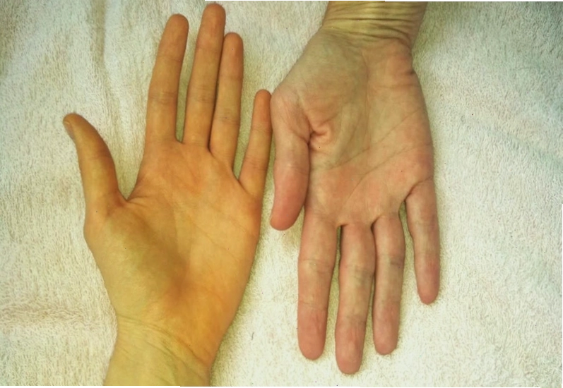 Nhiều nguyên nhân dẫn đến tình trạng vàng da