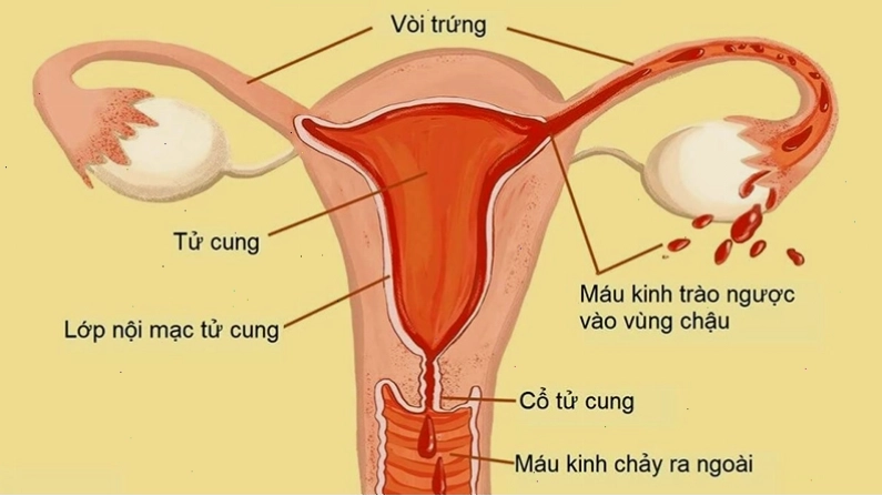 Nội mạc tử cung là lớp niêm mạc lỏng, xốp ở bên trong tử cung