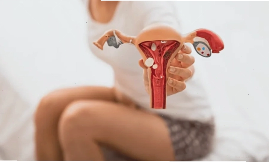 Phân biệt chảy máu âm đạo do u nang buồng trứng và các nguyên nhân khác