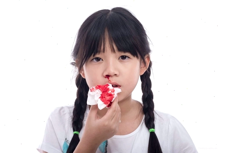 Phòng ngừa chảy máu cam bằng cách giữ ẩm không khí và vệ sinh mũi sạch sẽ
