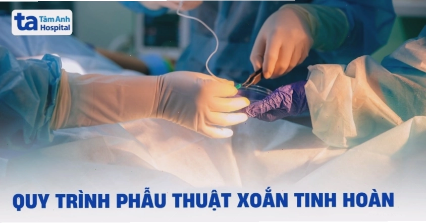 Quy trình phẫu thuật tháo xoắn tinh hoàn để bảo tồn chức năng